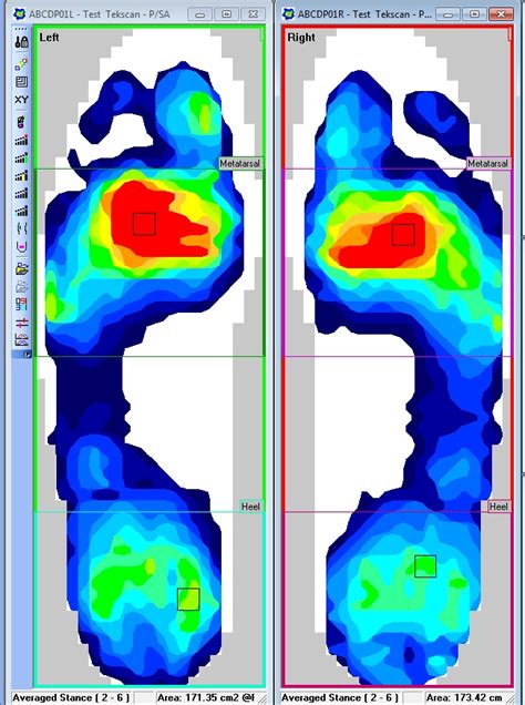 Pressure Mapping & Force Plates: The Building Blocks of Biomechanical ...