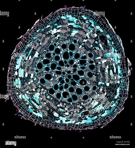 Plant Cells Under A Microscope