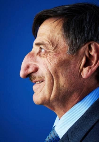 Mehmet Ozyurek has the world's largest nose, measuring 8.8 cm (3.46 in ...