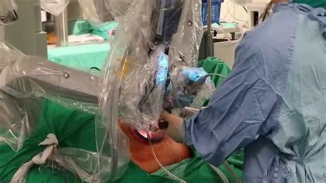 Single Port Robotic Sleeve Gastrectomy - YouTube