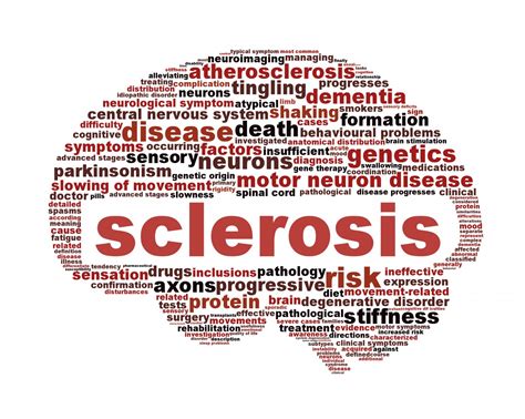 Spinal Cord Alteration in Multiple Sclerosis Could Lead to New Therapeutic Target