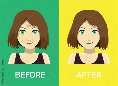 Botox Before After Face Manga Woman Cartoon Vector Illustration-01 ...