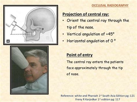 Occlusal radiography