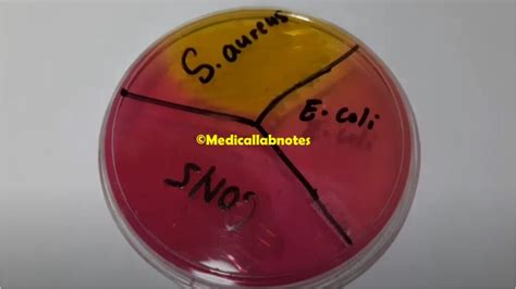 Mannitol Salt Agar (MSA): Introduction Archives - Medical Notes