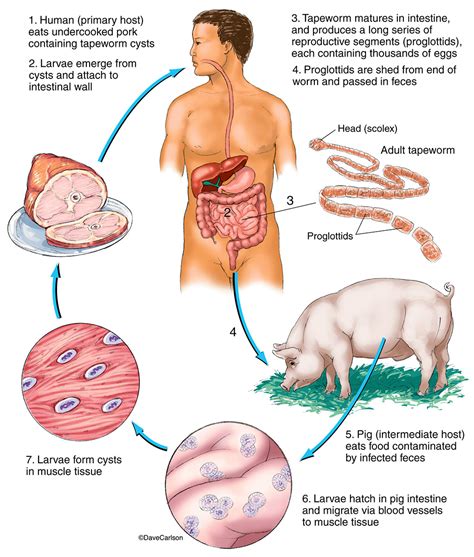 Tapeworm Life Cycle | Carlson Stock Art