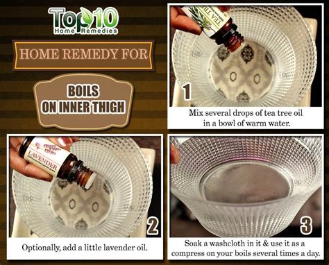 How To Get Rid of Boils on Inner Thigh | Top 10 Home Remedies