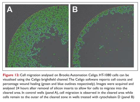 Cell Migration: Probing Cell Movement With Smarter Tools - Drug Discovery World (DDW)