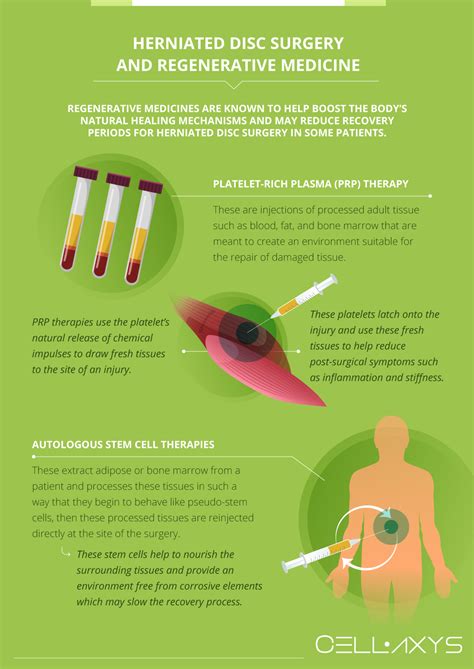 Herniated Disc Recovery Time - Cellaxys