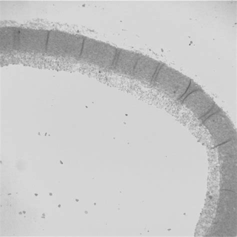 Plaques from the control group were observed under a light microscope... | Download Scientific ...