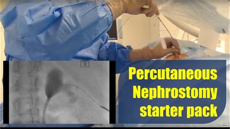 Percutaneous Nephrostomy procedure and technique: starter pack - YouTube