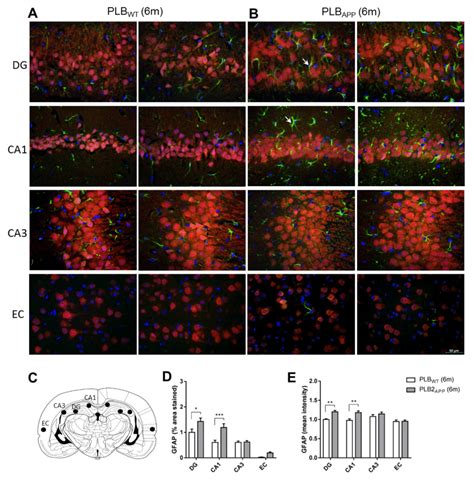 Expression and quantification of GFAP-labelled astrocytes co-localizing... | Download Scientific ...