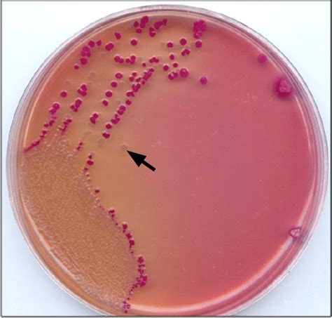 Pink Colonies Of E Coli On Macconkey Agar Download