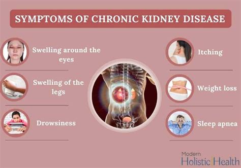 Chronic Kidney Disease – A Warning Sign for Millions