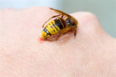 4 Common Summer Stinging Pests | Atlanta Pest Control