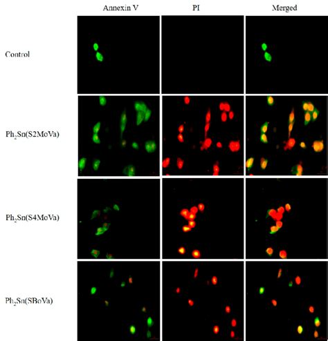 Apoptosis detection through fluorescence microscopy. Cells were treated ...