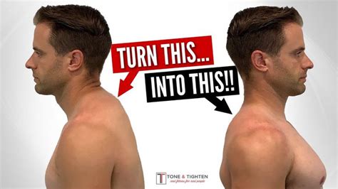 Fix Neck Hump FAST With These Home Exercises! - YouTube | Neck hump, Posture correction ...