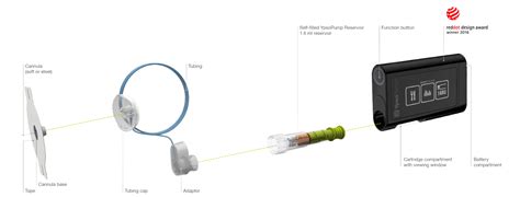 YpsoPump insulin pump - mylife Diabetescare - Canada