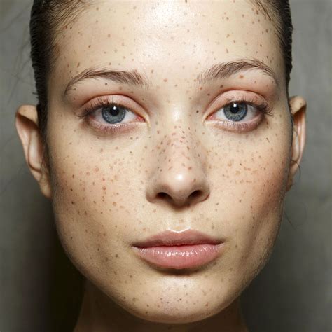 new freckle on face - pictures, photos