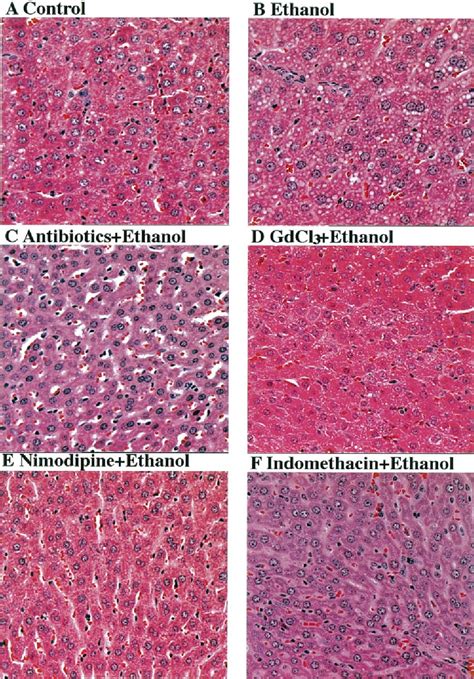 Liver Histology Kupffer Cells