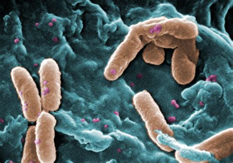 Pseudomonas aeruginosa - это... Что такое Pseudomonas aeruginosa?