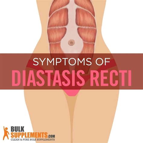 Tablo | Read 'Diastasis Recti: Symptoms, Causes & Treatment' by