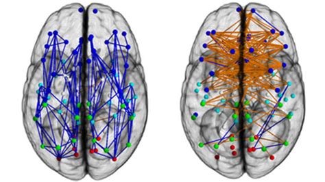 Men and women's brains are 'wired differently' - BBC News