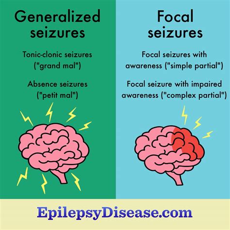 What Are The Types of Seizures With Epilepsy?