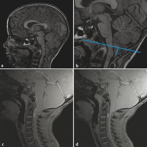 Part 2 Brain Imaging | Radiology Key