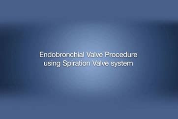 Endobronchial Valve Treatment - Olympus Professional Education On ...