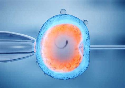 Blastocyst/Embryo Transfer Process | Anant IVF Centre