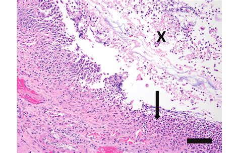 Histopathology. The transitional epithelium of the renal pelvis is ...