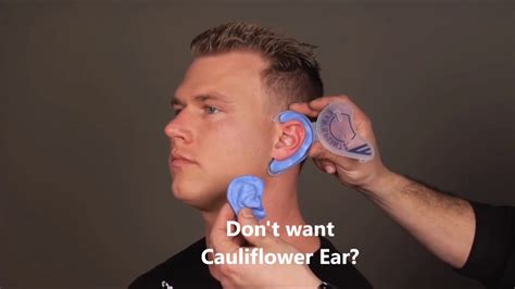 How To Prevent Cauliflower Ear - Treatbeyond2