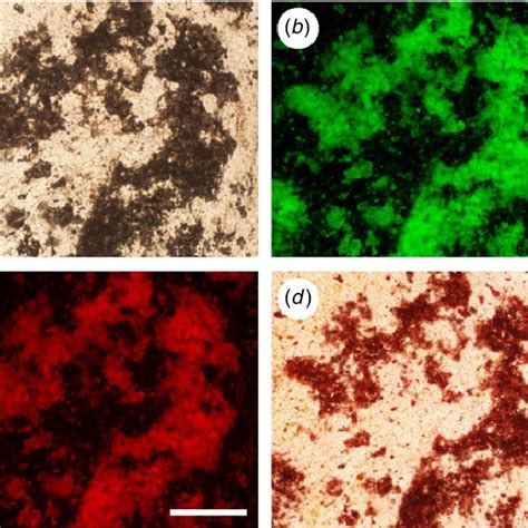 Control series with Alizarin Red S staining. The sample was stained ...