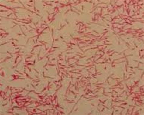 DL-012: Fusobacterium necrophorum, 3 CE | CAMLT