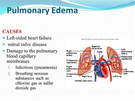 Pin on Advanced Pathophysiology