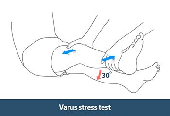 Knee Examination Harrow | Knee Arthritis Treatment Uxbridge | Knee Joint Pain London