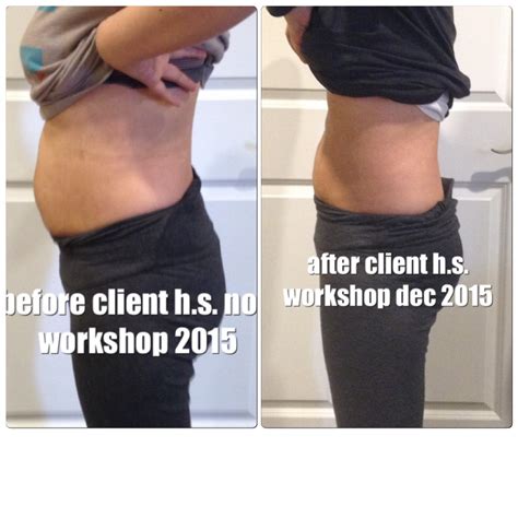 All New Before and After Pictures – Healing the Diastasis Recti 2015 – Beautiful After the Belly