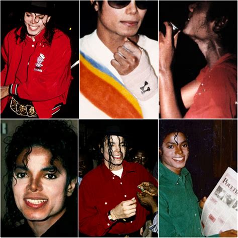 Vitiligo michael jackson – Artofit