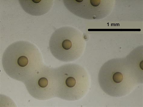 Mycoplasma Pneumoniae Colonies