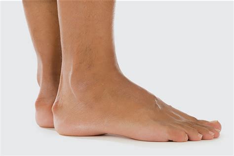 Heel Pain - Causes, Symptoms and Treatment | Sanders Podiatry Adelaide