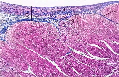 Cardio Vascular System | Histology | Anjani mishra