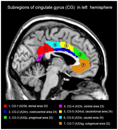 Aberrant functional connectivity of the cingulate subregions in right ...