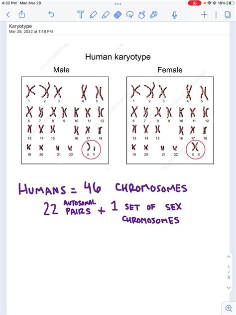 SOLVED: A normal human karyotype has . a) 46 chromosomes b) 23 autosomes c) 20 pairs d) 45 ...