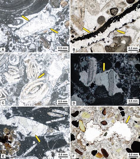 Photomicrograph showing: a micrite envelopes around a bivalve fragment ...