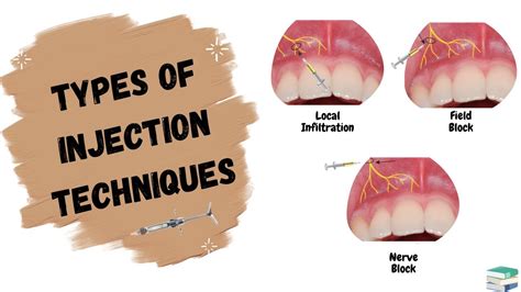 Types Of Dental Anesthesia Side Effects at John Mccray blog