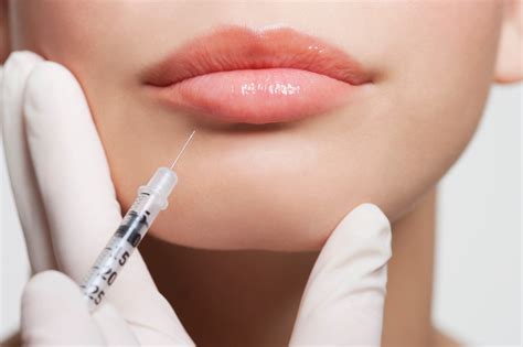 Facial Fillers and Injections Are the Biggest Trends in Plastic Surgery | SELF