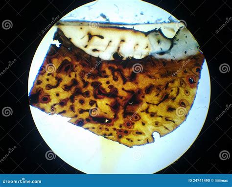 Osteocyte; Osteocytes; Bone Cell Stock Photo - Image of microscope, nature: 24741490