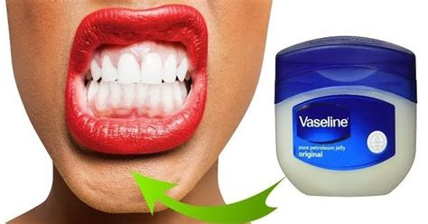 TURN YELLOW TEETH TO PEARL WHITE WITH VESLINE APPLY VASELINE TO YOUR ...