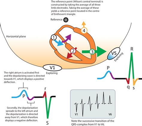 ECG interpretation: Characteristics of the normal ECG (P-wave, QRS complex, ST segment, T-wave ...