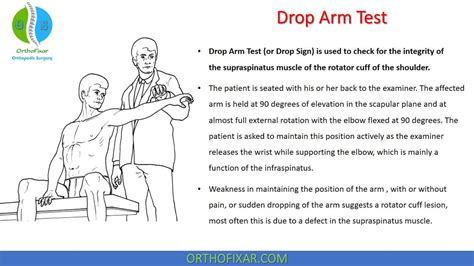 Drop Arm Test For Supraspinatus Tear | OrthoFixar 2024